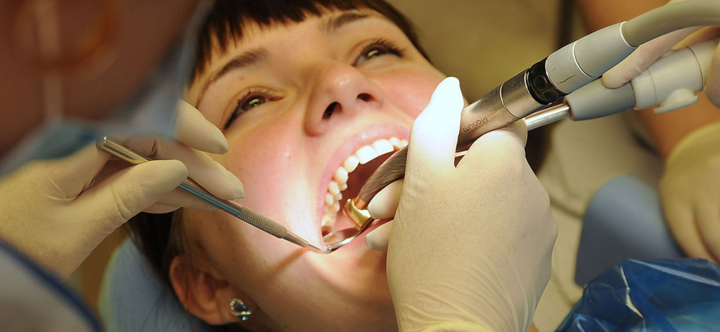Пломбирование пастой корневого канала зуба