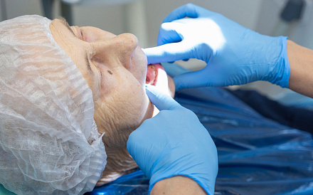 Можно ли не удалять зубы мудрости при установке брекетов?