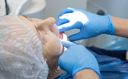 Виды зубных коронок и какие лучше выбрать?