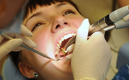 Пломбирование пастой корневого канала зуба