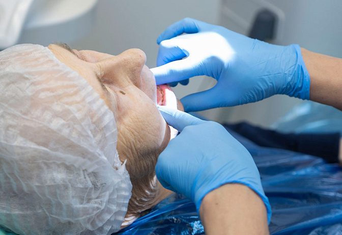 Выпала коронка: что делать, как сохранить зуб и восстановить протез