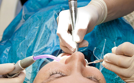 Реминерализующая терапия зубов