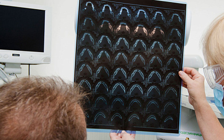 Пульпотомия: разновидности, особенности метода