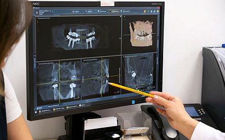 Прыщ во рту: симптомы, причины, методы лечения и профилактика